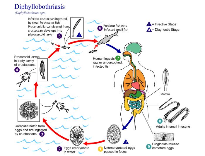 diphyllobothriasis teniasis