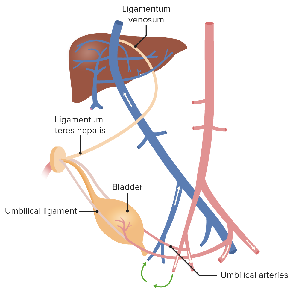 Ligamento redondo hepático ligamento umbilical