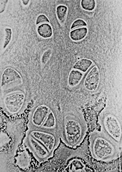 Light micrograph of an epiphyseal plate showing chondrocytes