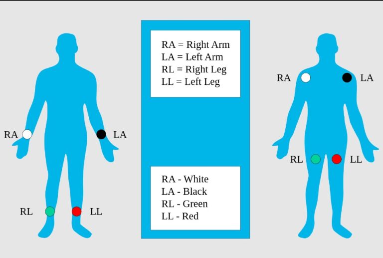 12 Lead Ecg Placement Step By Step Guide Lecturio Medical 5858