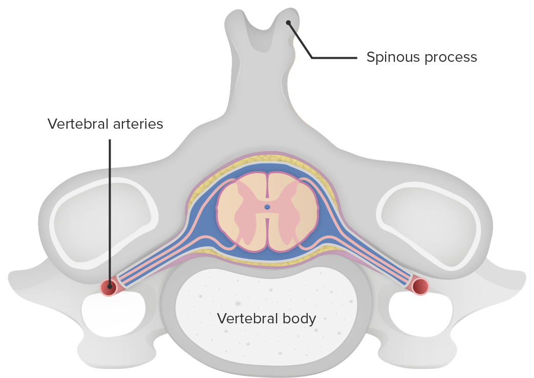 Location of cross-section of spinal cord