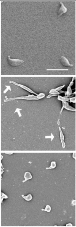 Mycloplasma genitalium morphology micrograph