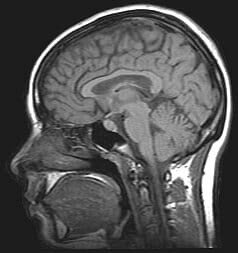Magnetic resonance image of a human brain