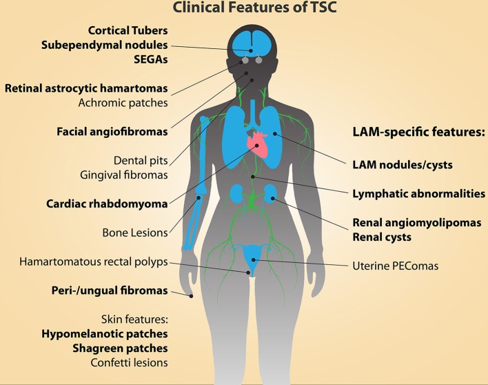 Principais características diagnósticas do tsc