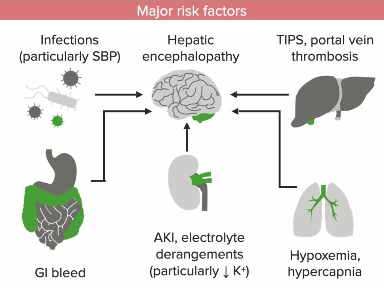 Hepatic Encephalopathy | Concise Medical Knowledge