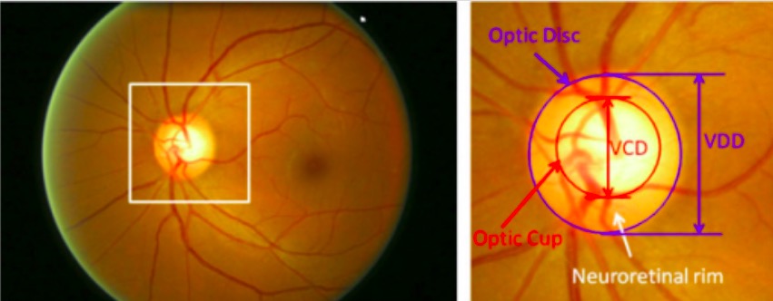 Major structures of the optic disc
