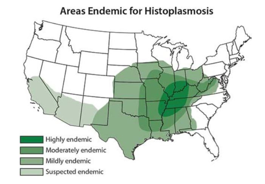 Mapa das áreas dos estados unidos endêmicas para histoplasmose