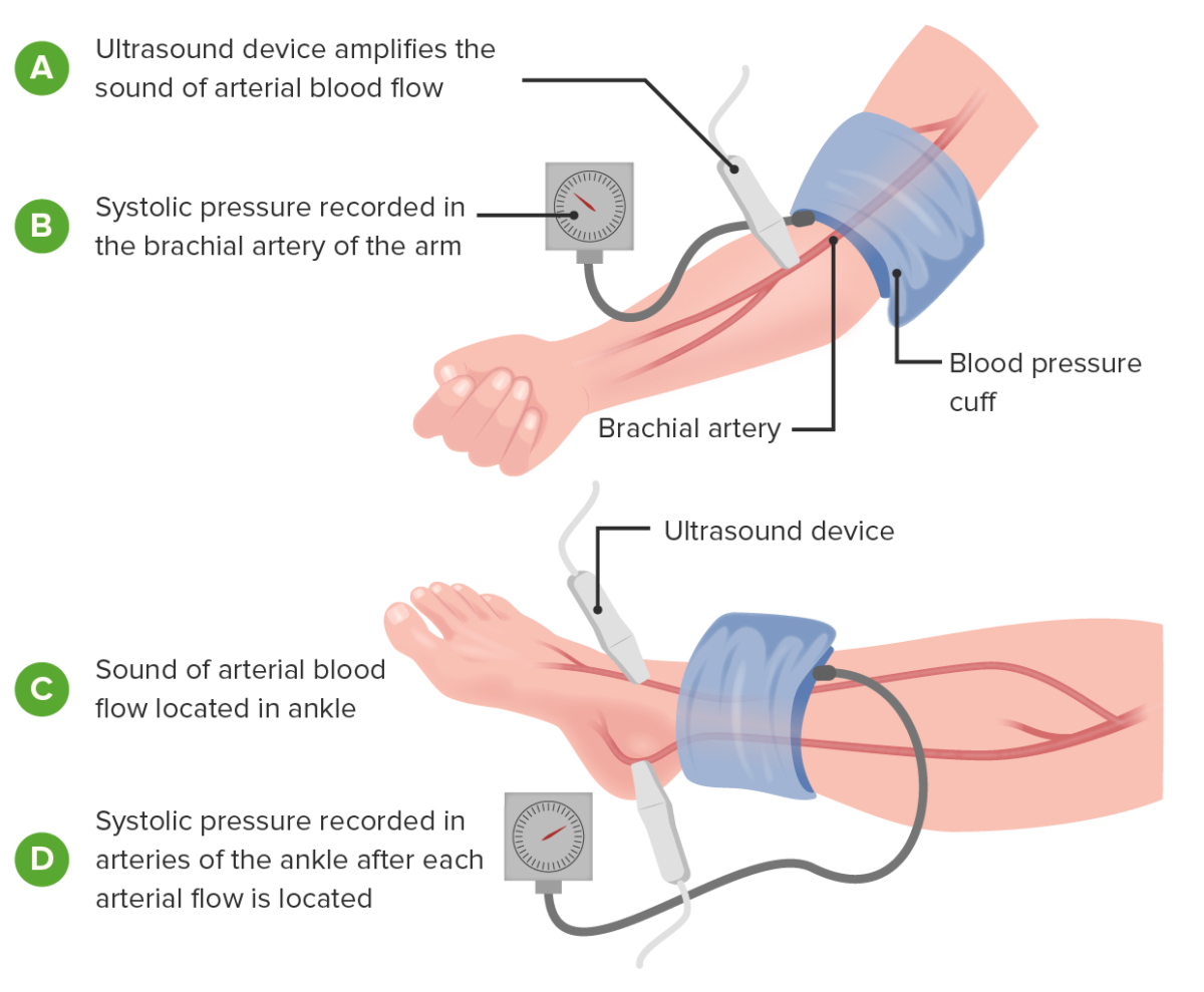 Measure the ankle-brachial index