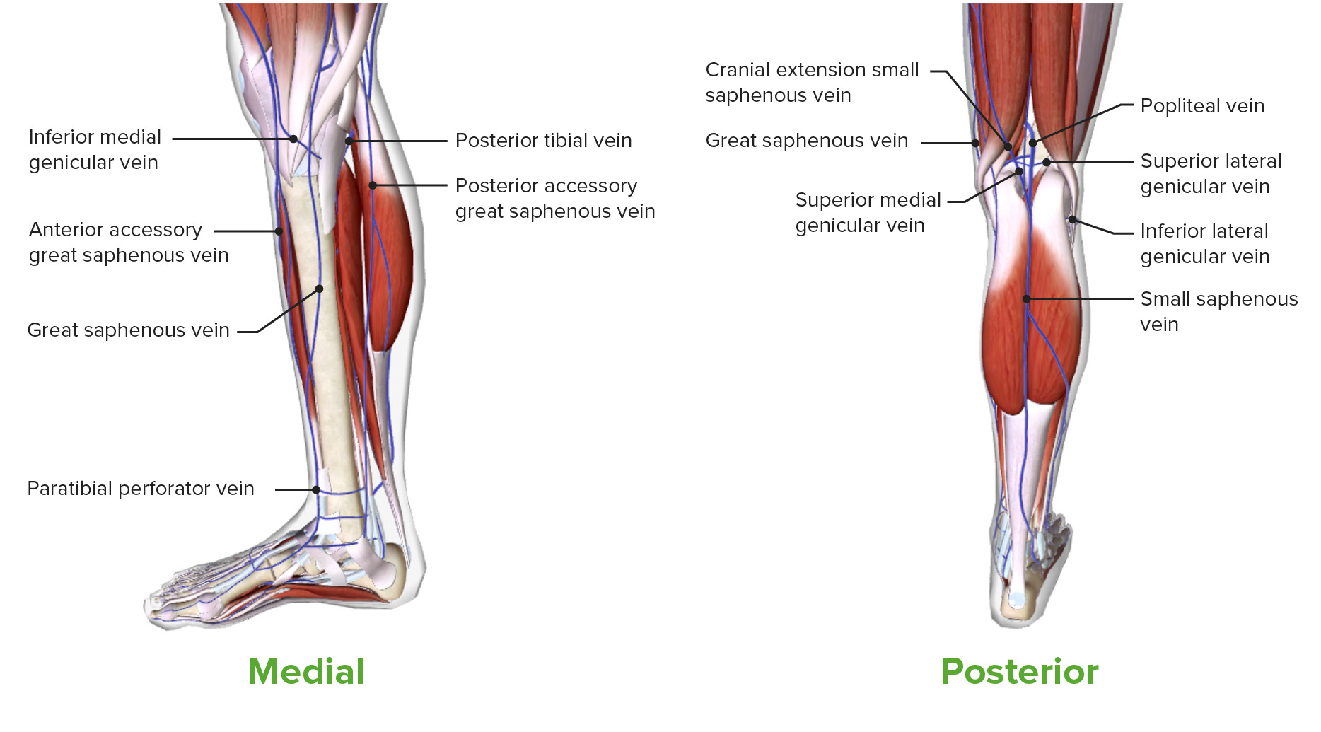 Photograph of left lower leg medial aspect (left) and anterior aspect