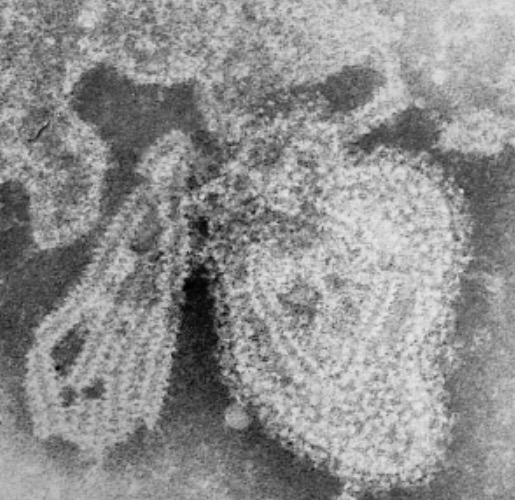 Micrograph of a mumps virus