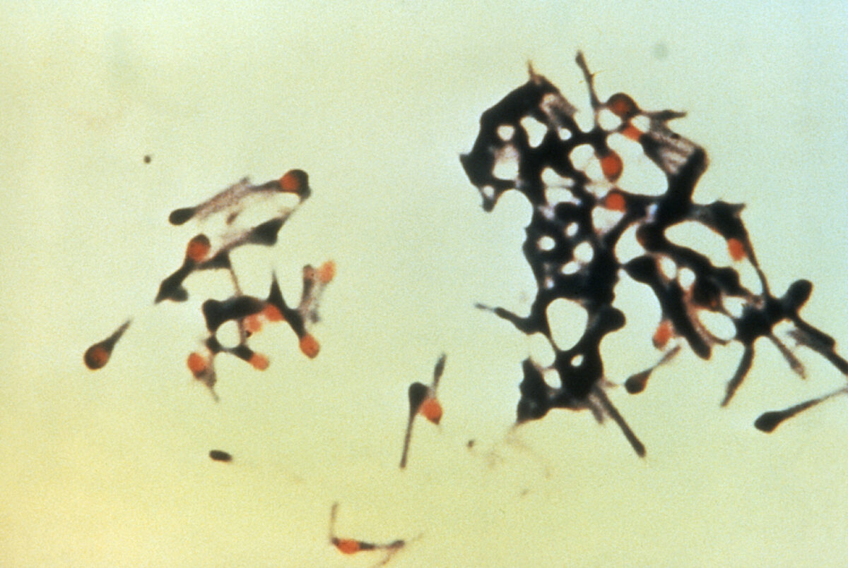 Micrograph of group of clostridium tetani bacteria