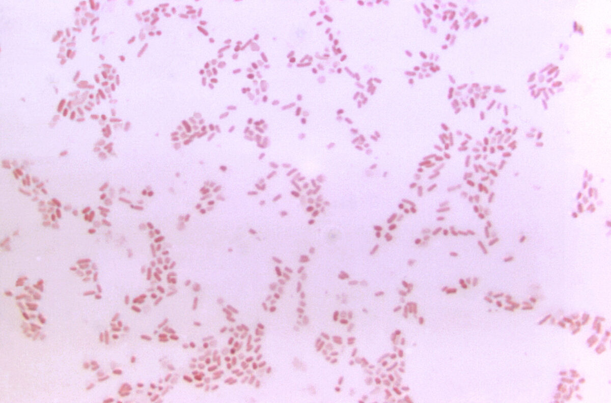 Micrografía de bacteroides