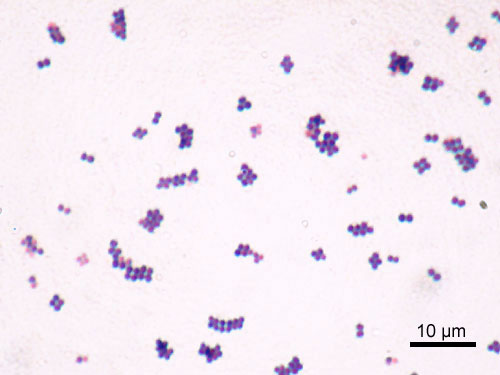 Microscopic image of staphylococcus aureus