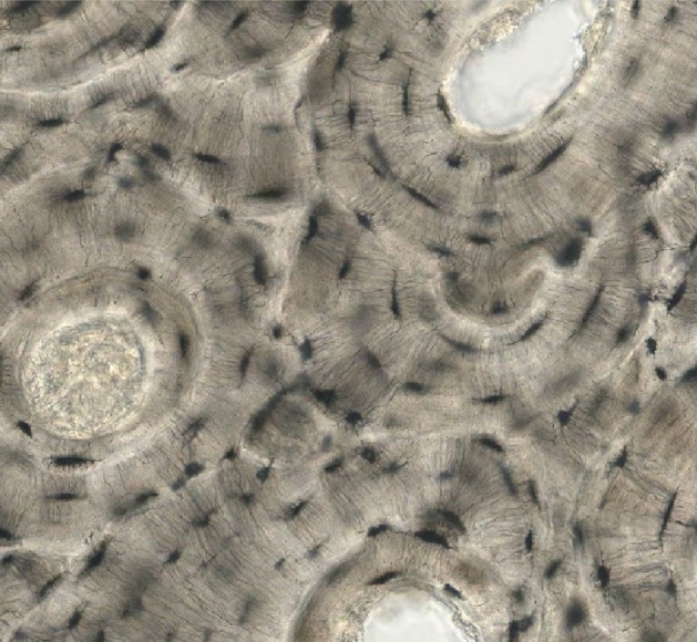 Microscopic image of osteon