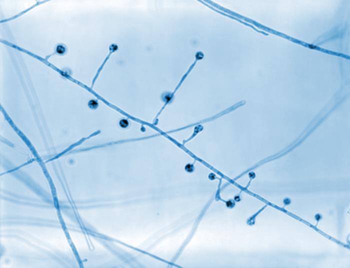 Morphology exhibited by the fungal organism, blastomyces dermatitidis
