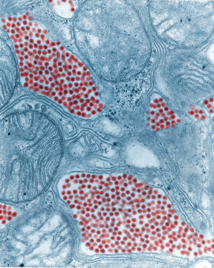 Mosquito salivary gland - eastern equine encephalitis