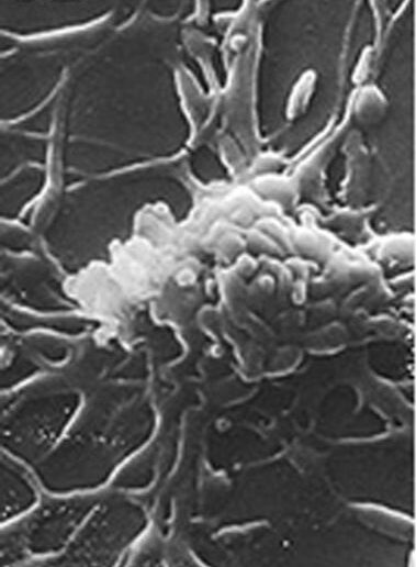 Mycoplasma pneumoniae cells attached to ciliated mucosal cells