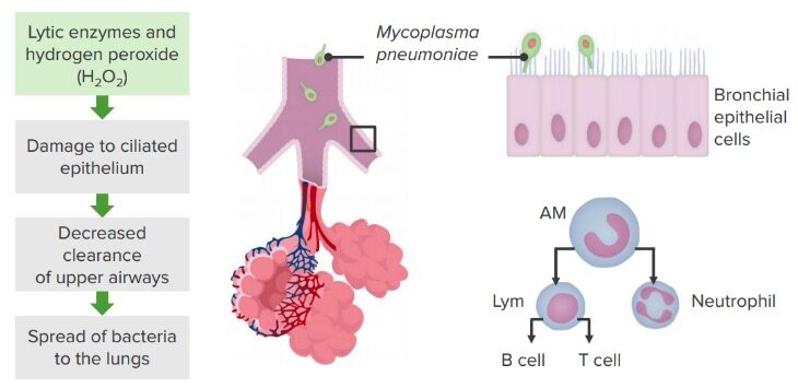 Mycoplasma pneumoniae pathogenesis