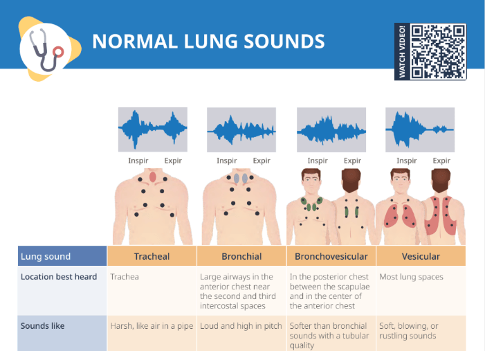 Thumbnail for Lecturio's Normal Lung Sounds Cheat Sheet