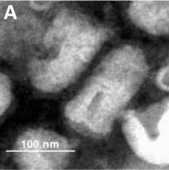 Negatively stained rhabdovirus rabies