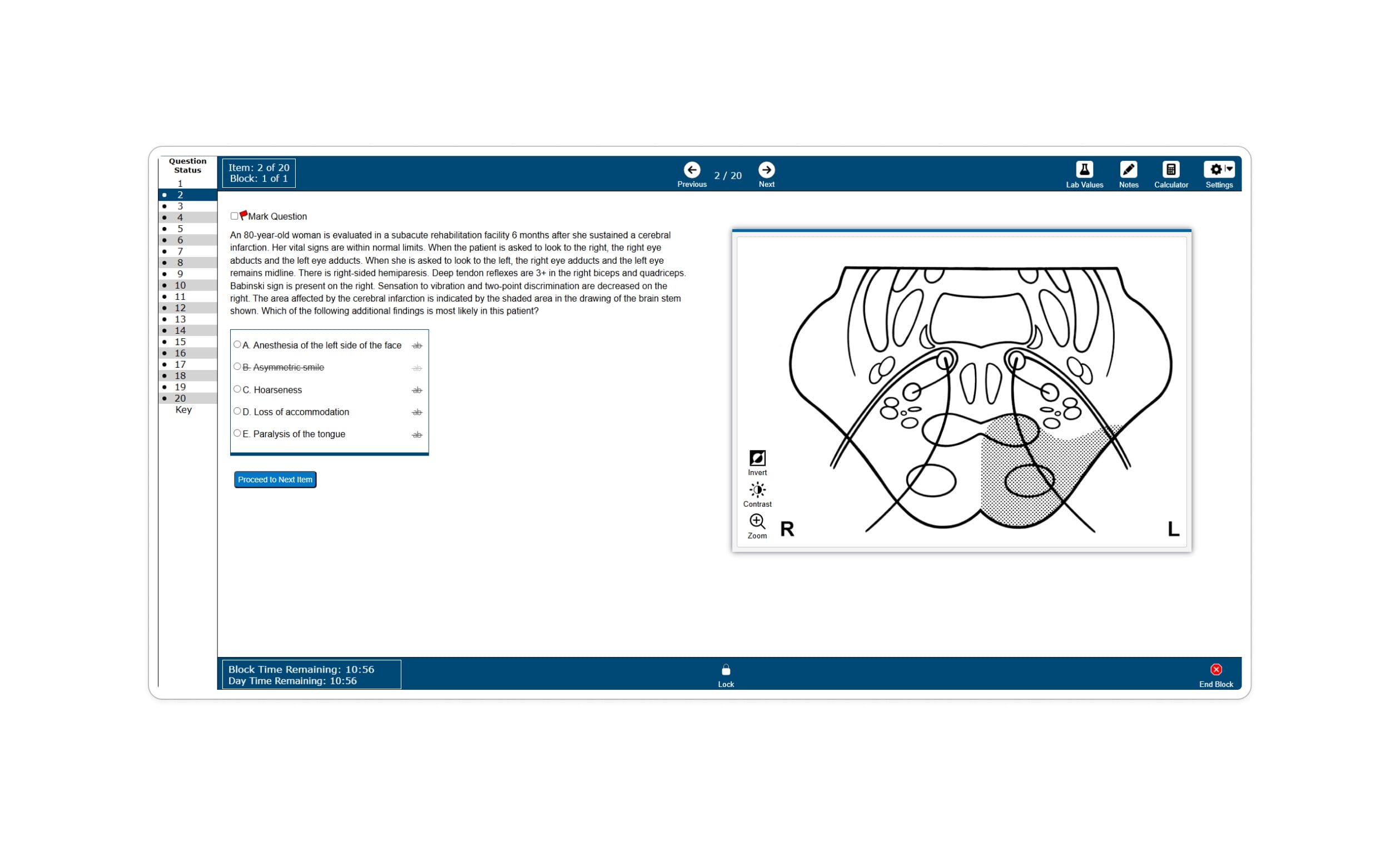New usmle interface Lecturio's usmle qbank environment