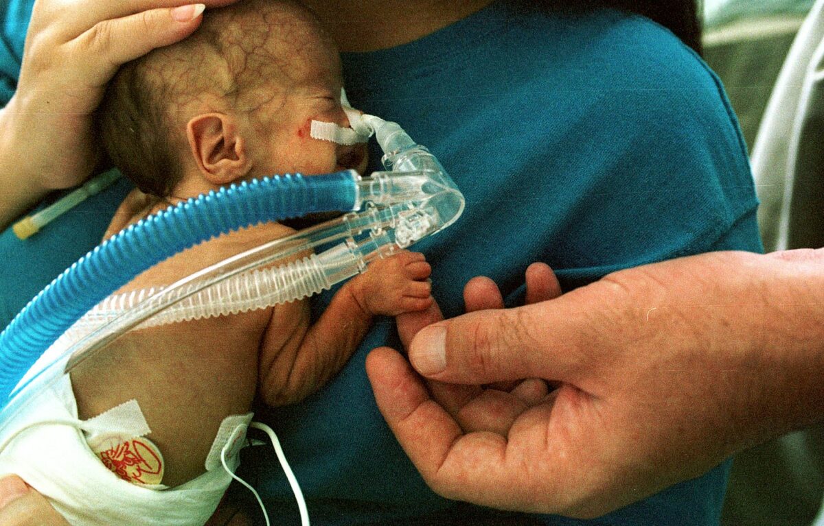 Newborn premature infant on cpap