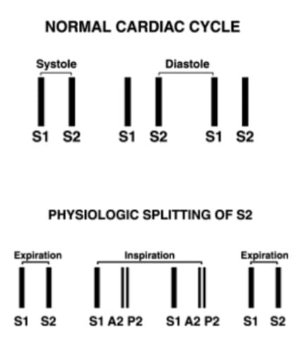 Normal cardiac cycle and splitting of s2