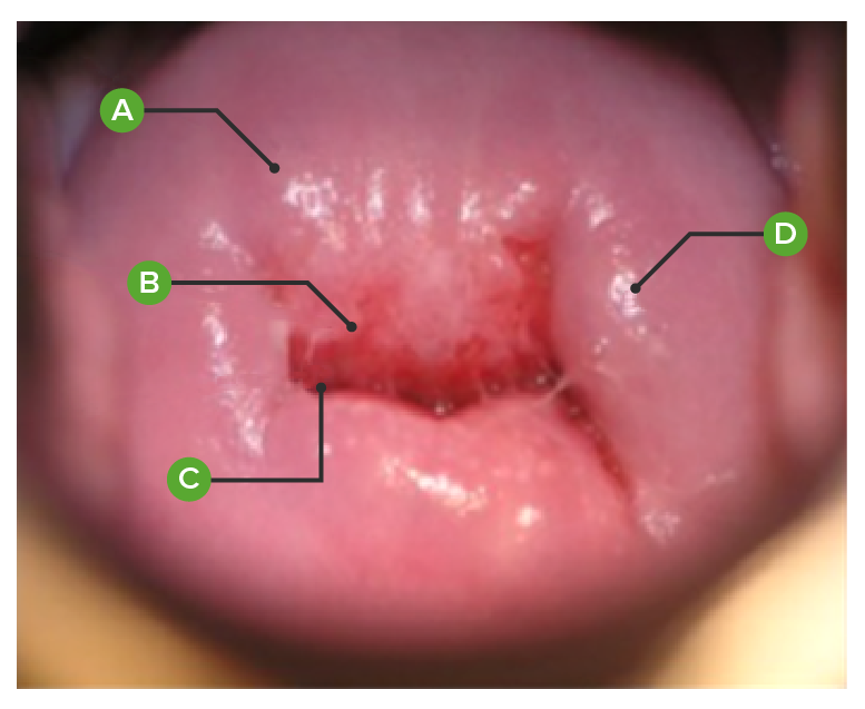 normal cervical os