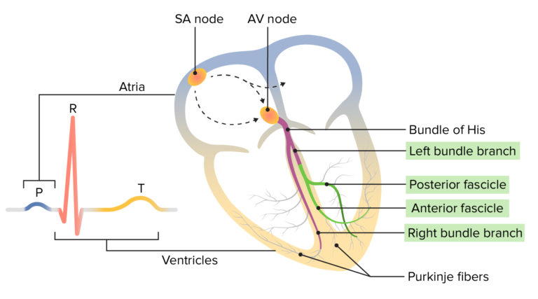 Bundle Branch And Fascicular Blocks 