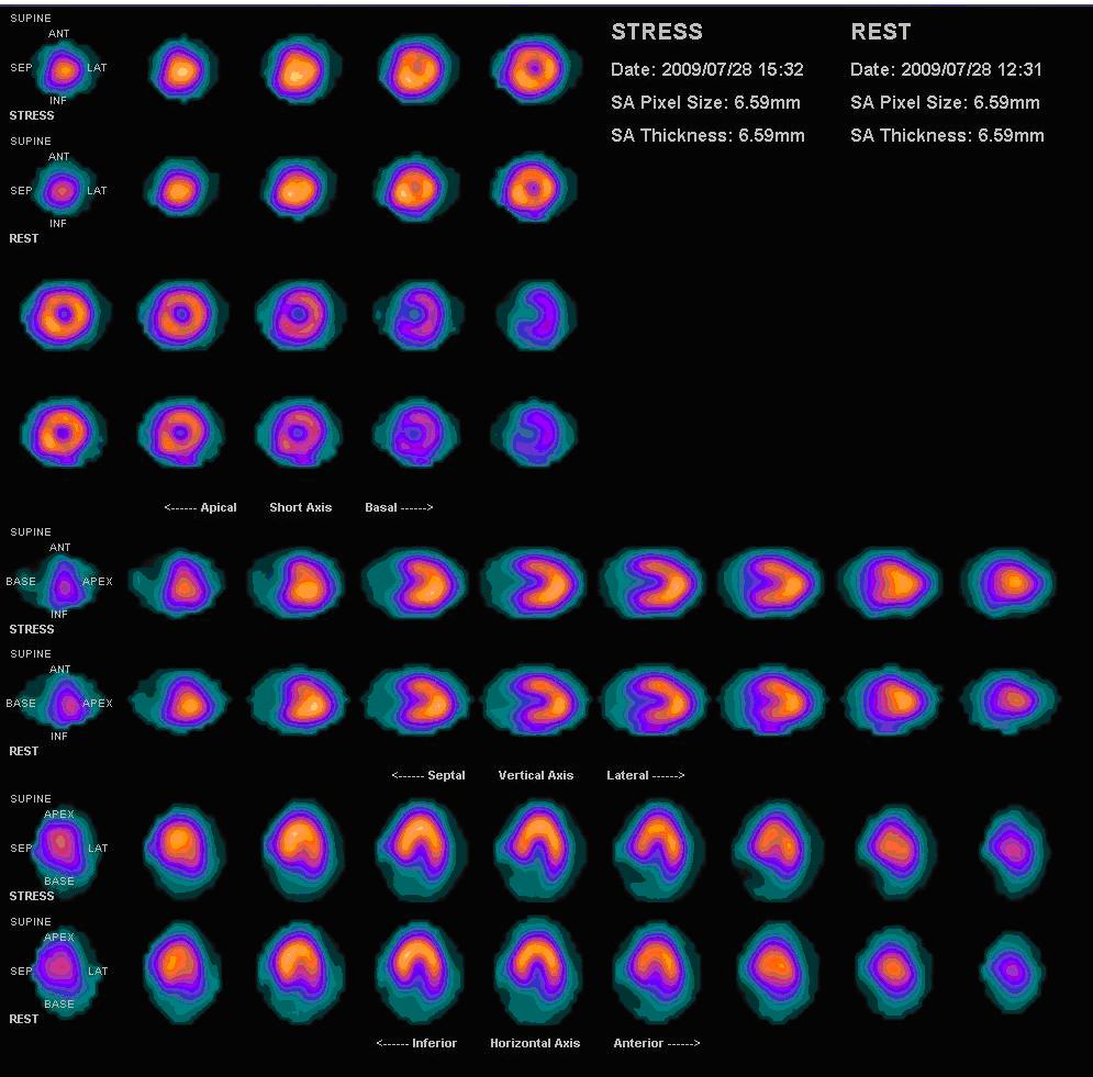 imaging-of-the-heart-and-great-vessels-concise-medical-knowledge