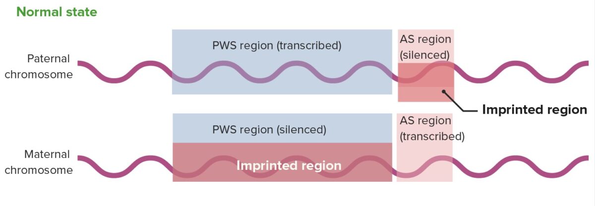 Normal state of gene expression