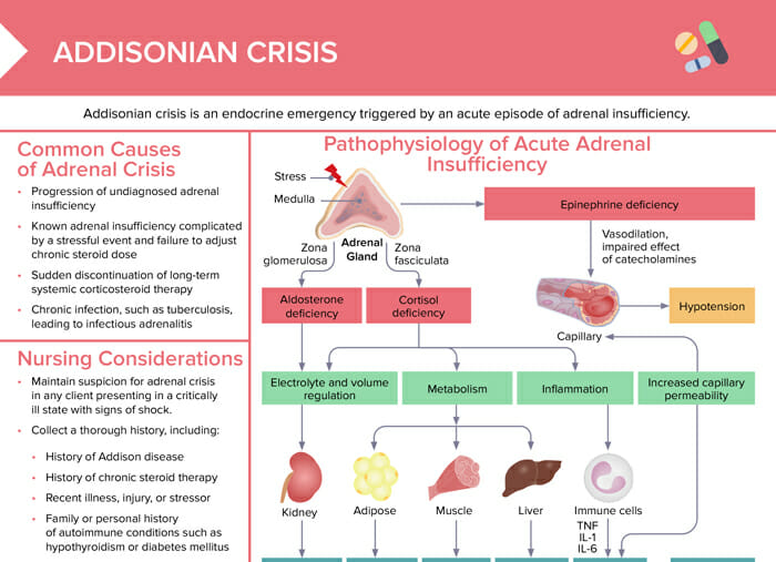 Addisonian crisis [+ free cheat sheet] | lecturio nursing