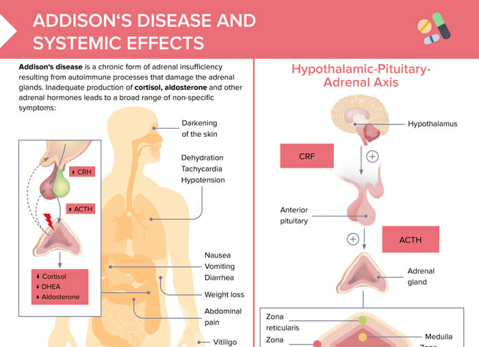 addison disease histology