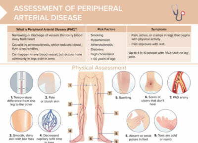 Reviews pad, symptoms, physical assessment and diagnosis