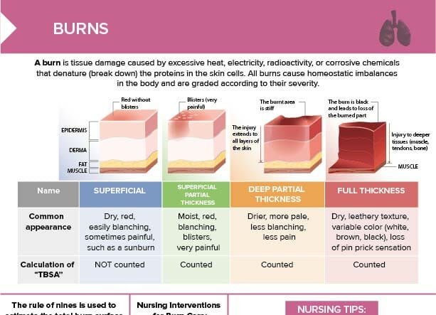 Burns: Classification [+ Free Cheat Sheet] | Lecturio