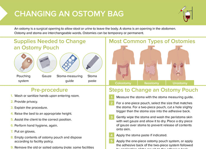 Stoma Assessment Free Cheat Sheet Lecturio Nursing