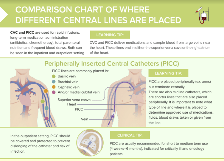 Catetere Groshong vs linea Picc