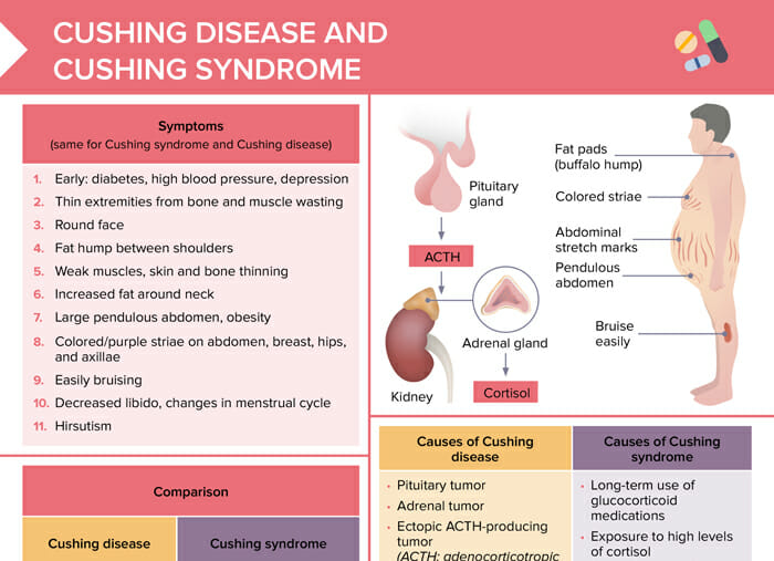 Cushing syndrome and cushing disease