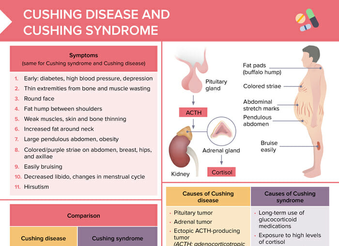 Cushing Syndrome: What is It, Causes, Treatment, and More