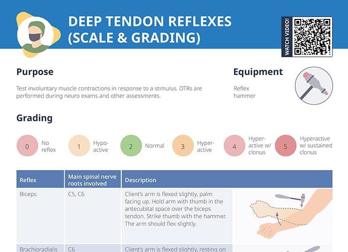 Deep Tendon Reflexes [+ Free Cheat Sheet] | Lecturio Nursing