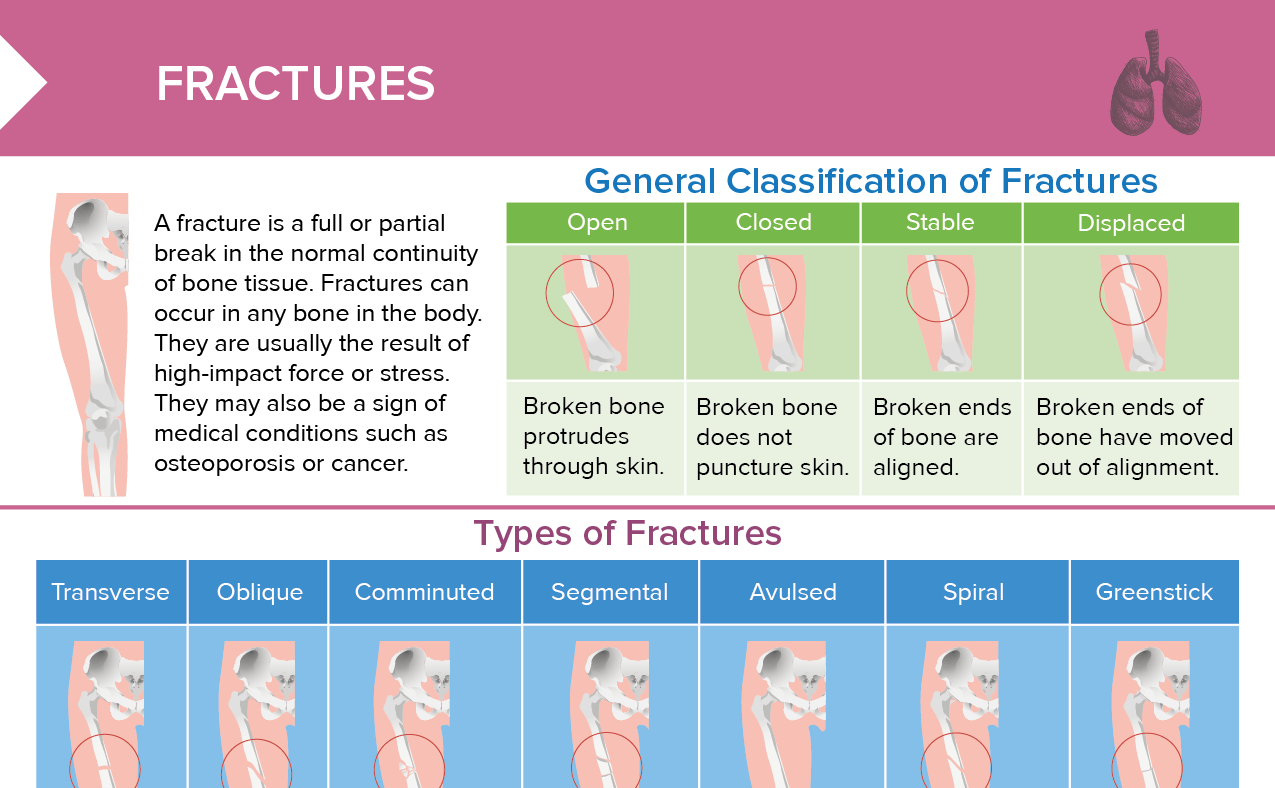Pathological Fracture Types