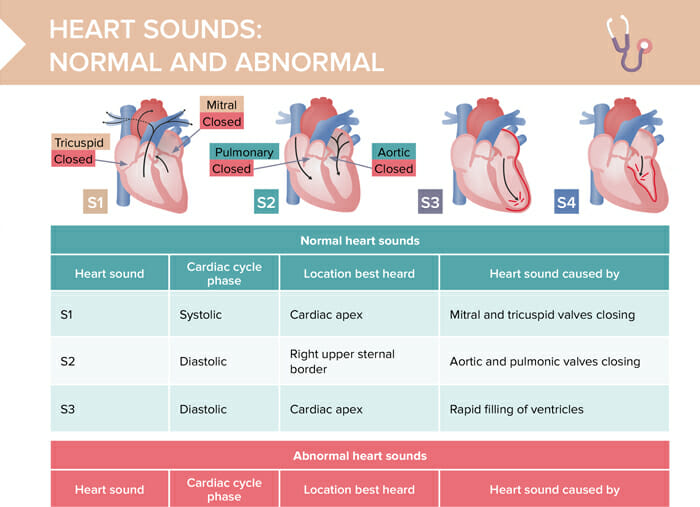 An overview of normal and abnormal heart sounds, such as murmurs and clicks
