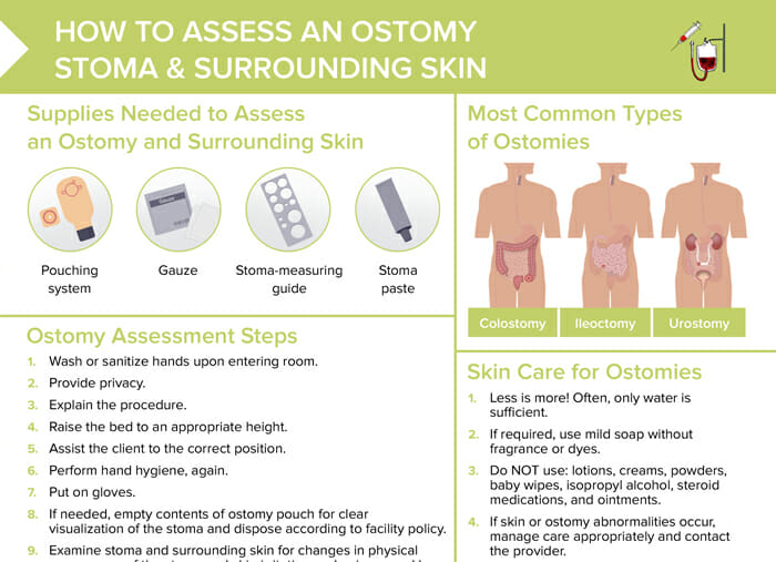 An overview on ostomy and skin assessment and management