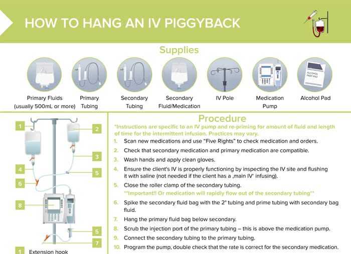 IV piggyback medication concept map - Procedure or device: IV piggyback  medication Definition: A - Studocu