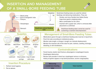Nursing cs insertion and management of a small bore
