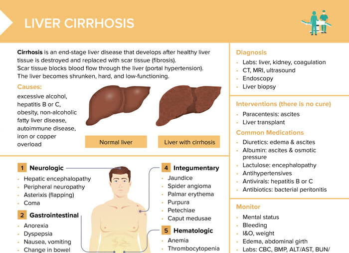 Liver Cirrhosis Free Cheat Sheet Lecturio Nursing