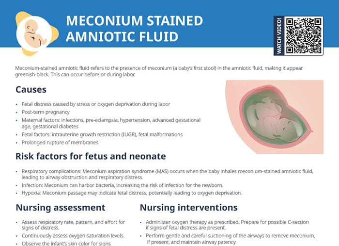 Meconium stained amniotic fluid