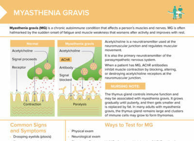 Myasthenia gravis is a rare, chronic autoimmune condition that affects muscles and nerves.