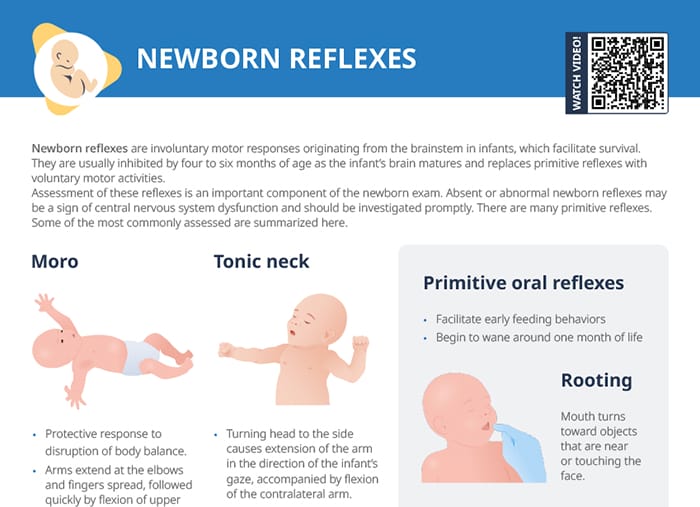 Newborn reflexes