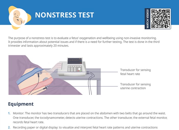 Nonstress test